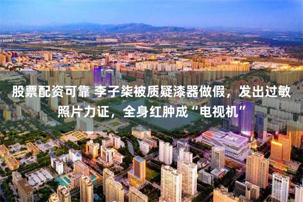 股票配资可靠 李子柒被质疑漆器做假，发出过敏照片力证，全身红肿成“电视机”